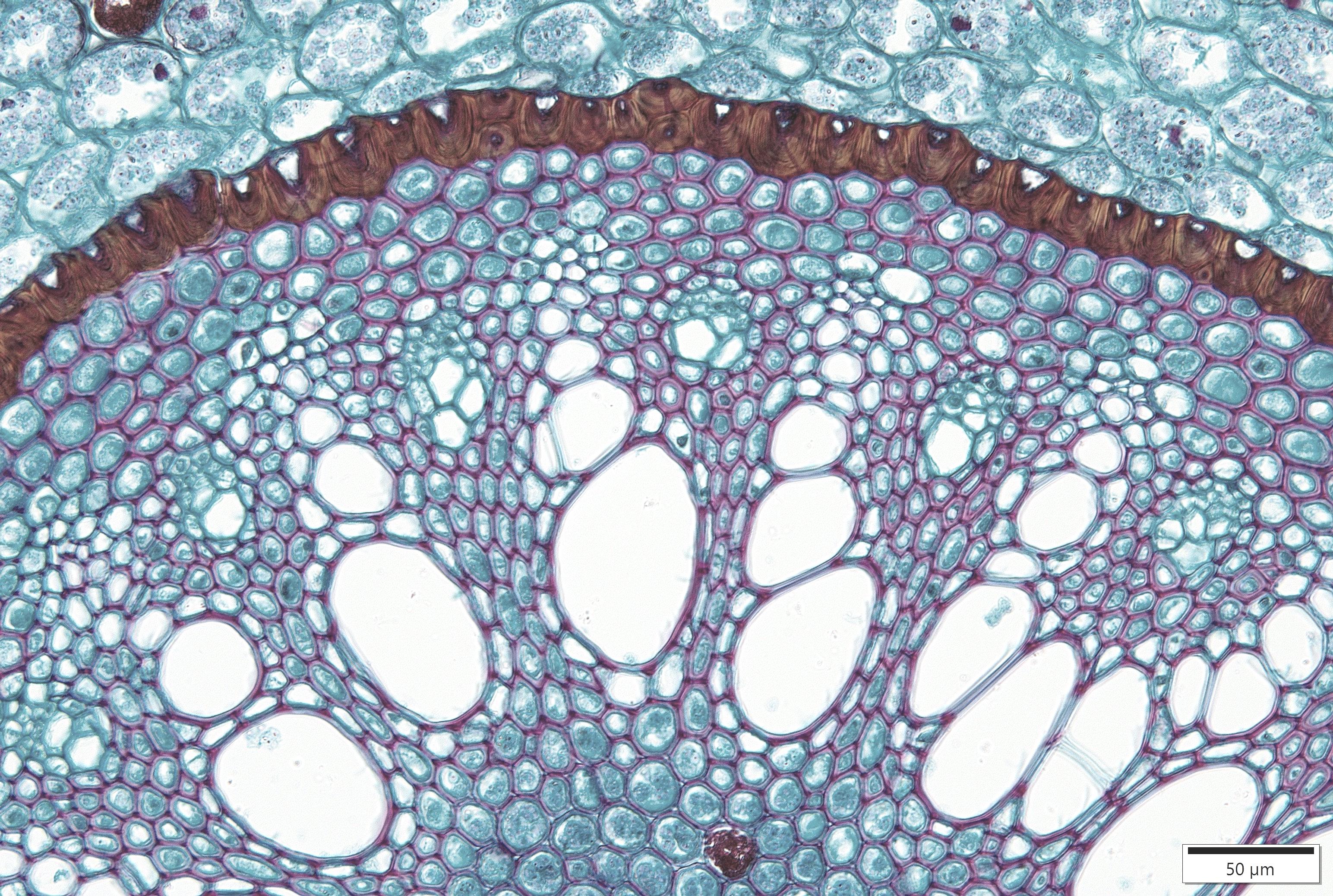 Another view of a Smilax root steleshowing the xylem and phloem tissues