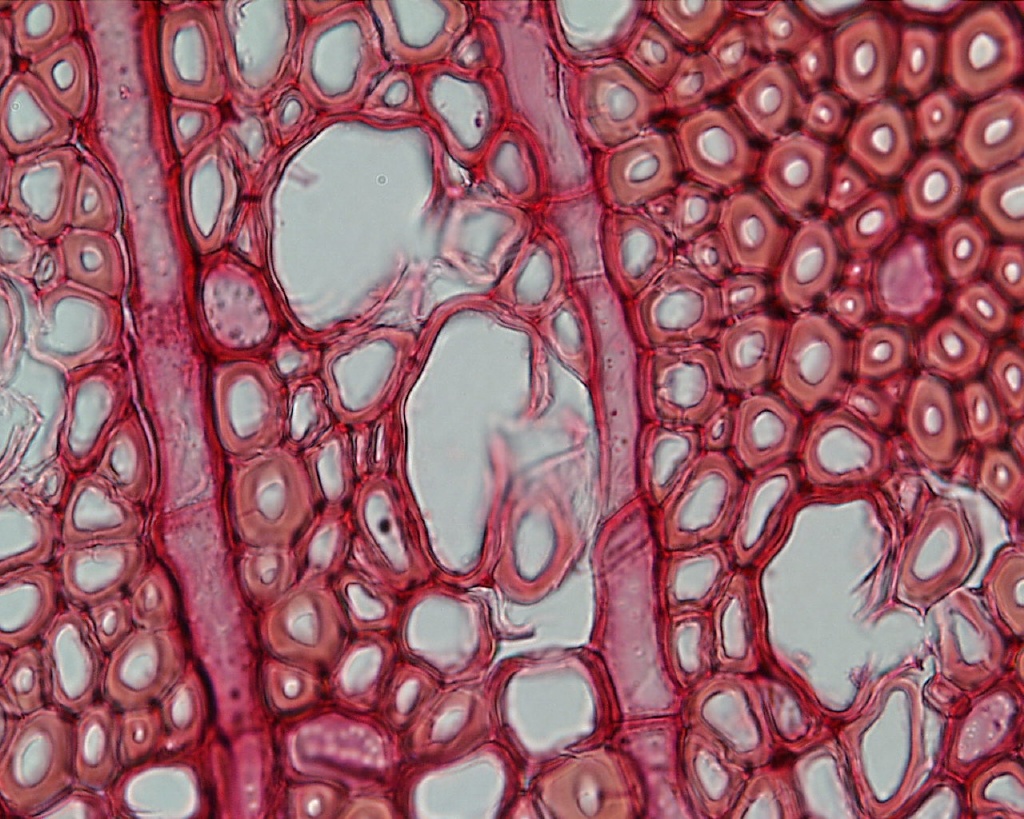 Клетки ксилемы живые. Ксилема микропрепарат. Ксилема и флоэма гистология. Гистология растений. Механическая ткань под микроскопом.
