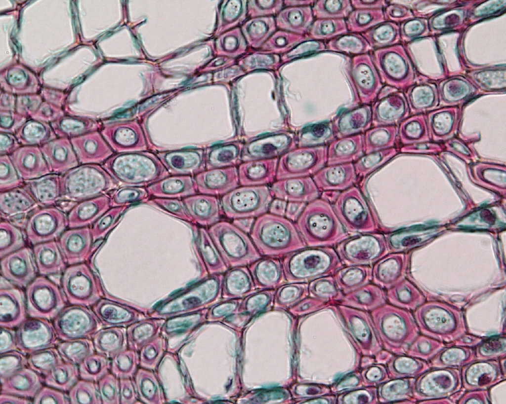 Микропрепараты ботаника. Ксилема микроскоп. Запасающая ткань растений под микроскопом. Водозапасающая паренхима. Запасающая паренхима клубня картофеля.